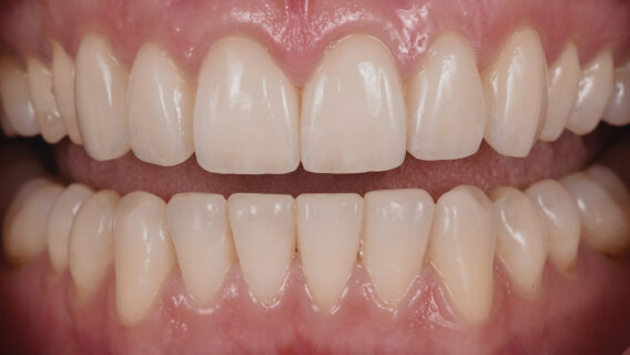 Oral Design Center Holland - ODCH_Casus_1-3