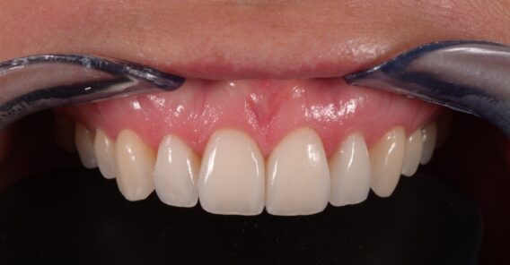 Oral Design Center Holland - mockup3