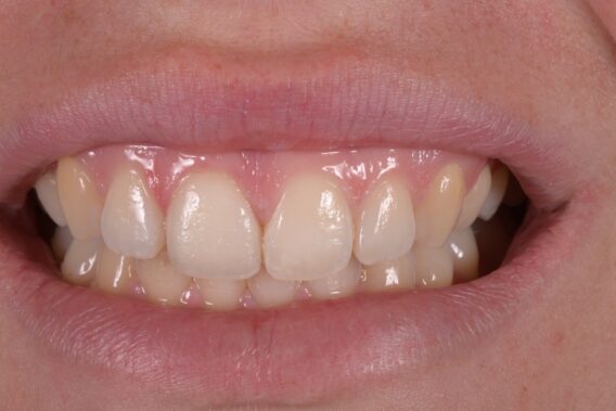 Oral Design Center Holland - ODCH3