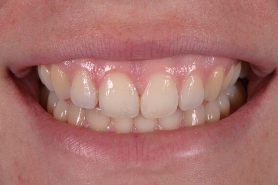 Oral Design Center Holland - ODCH4