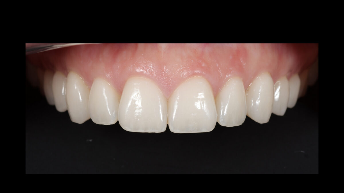Oral Design Center Holland - xx.001