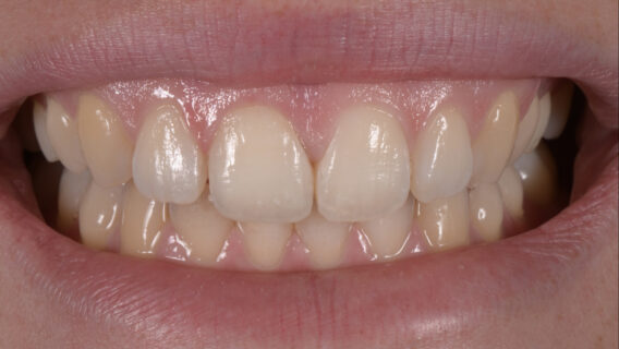Oral Design Center Holland - afbak.003