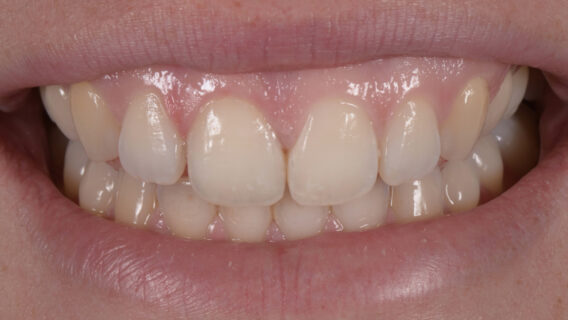 Oral Design Center Holland - afbak.004