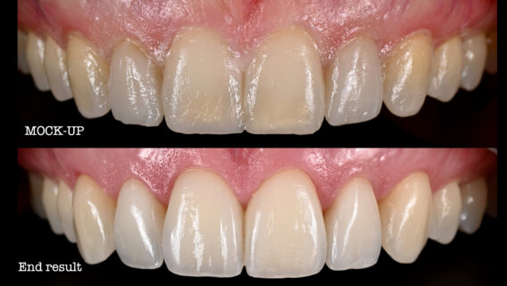 Oral Design Center Holland - mockup1.001